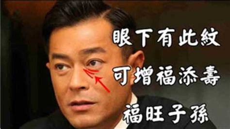 眼下發青面相